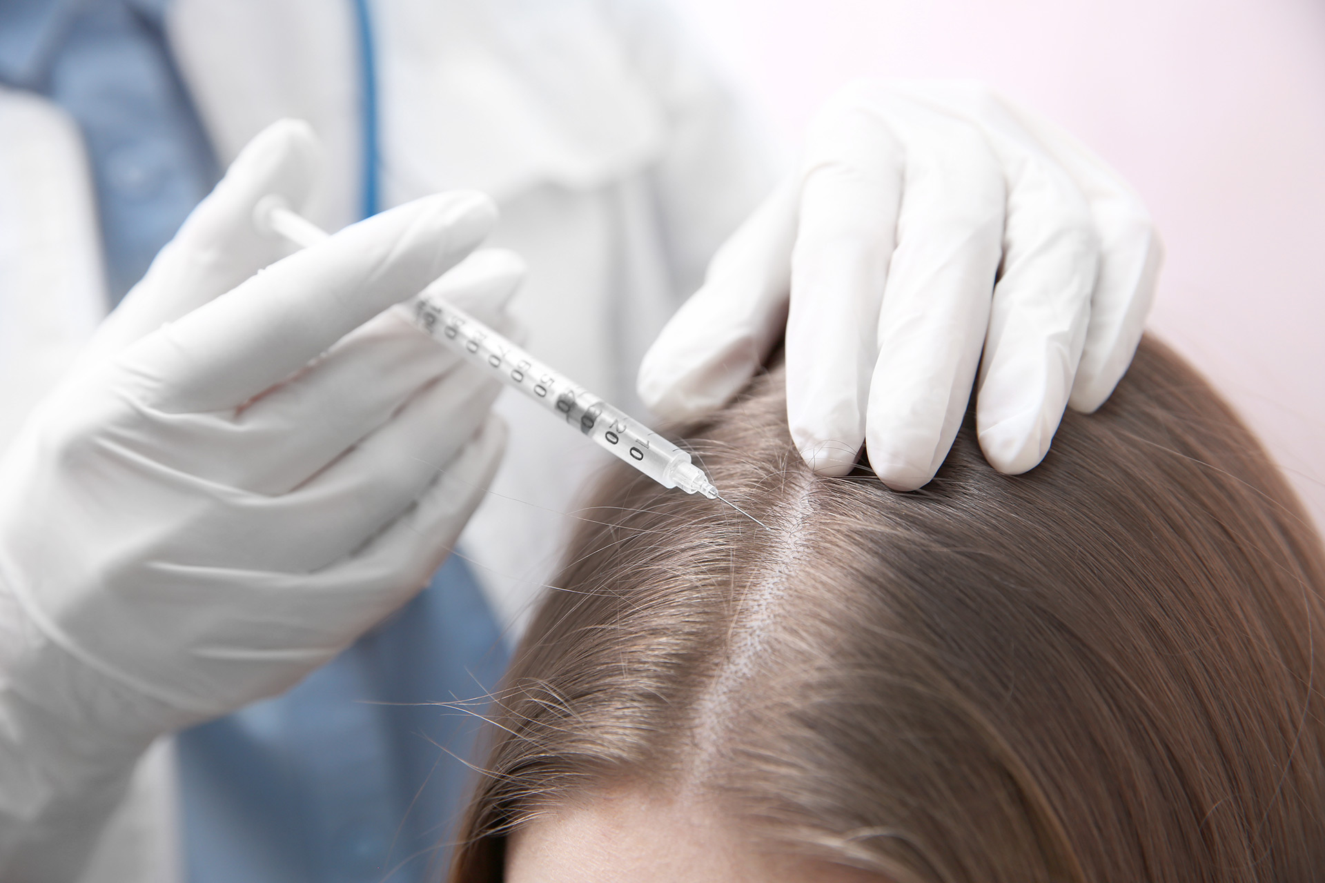 Haarmesotherapie: Eine Effektive Lösung für Gesundes und Volles Haar